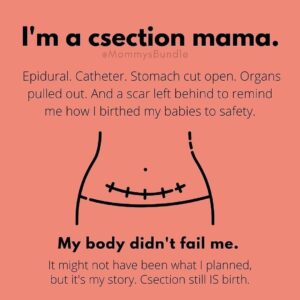 I am a C section mama
