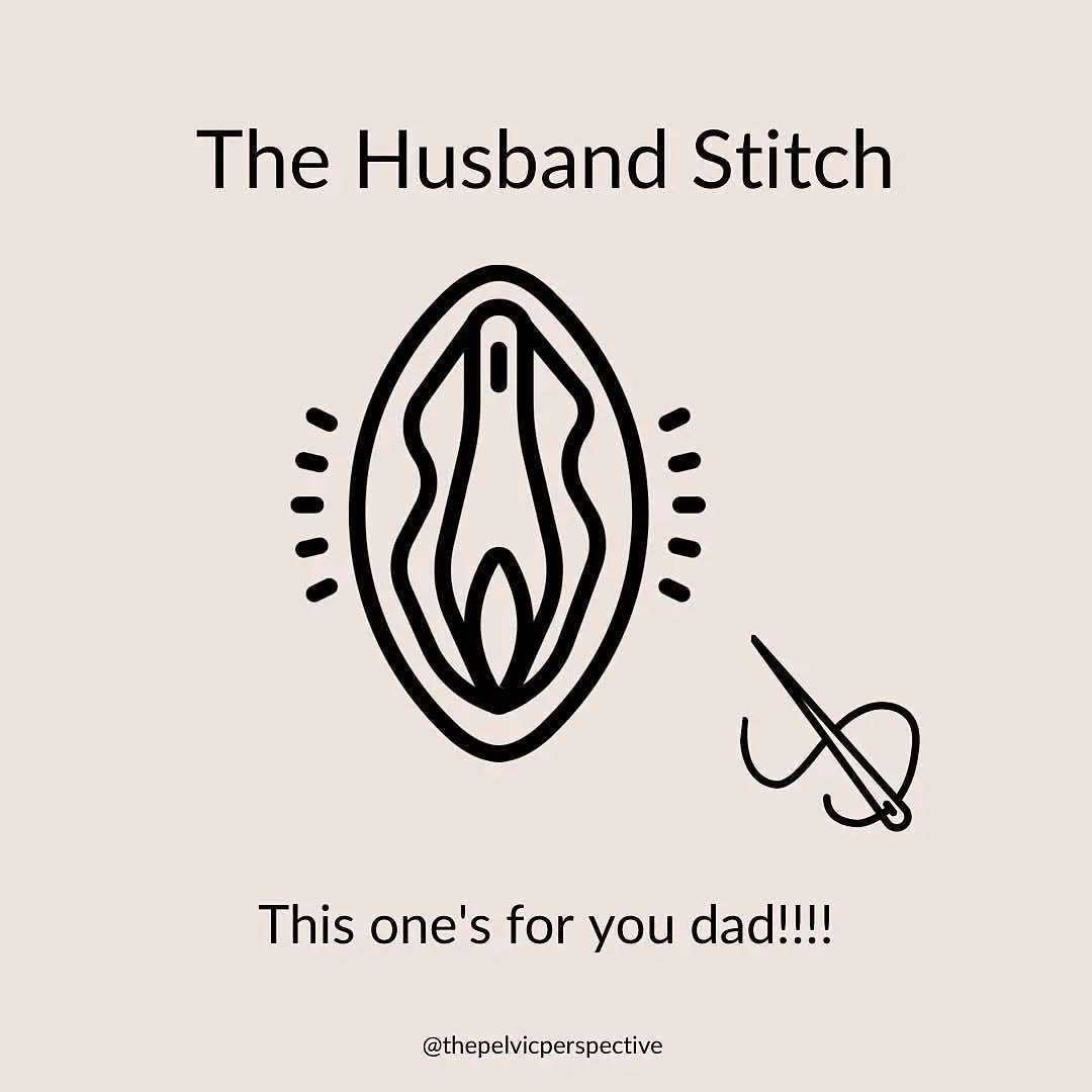 The Husband Stitch